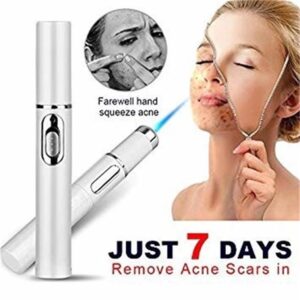 Blue Light Acne Laser Therapy Pen – Wrinkle & Scar Removal Device for Clear, Youthful Skin